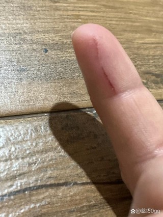 被猫咪抓了没出血？被猫抓了出一点血要打针吗（最新）