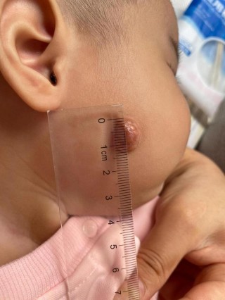 猫咪肉芽肿能自愈吗，（猫咪肉芽肿能自愈吗图片）