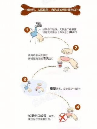 怎么防止狗狗舔伤口，防止狗狗舔伤口神器叫什么名字？