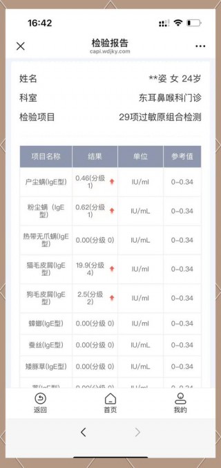 对猫咪过敏的症状，（对猫咪过敏的人症状）