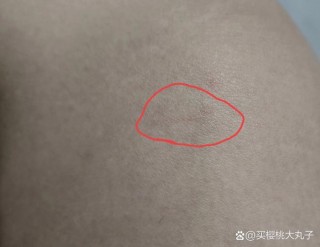 狗狗破皮了擦什么药，（狗狗破了一块皮需要注意什么）