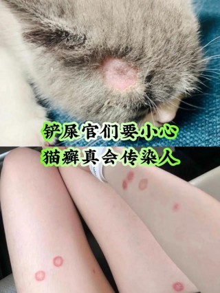 猫咪传染给人的病，猫咪传染给人的病毒？