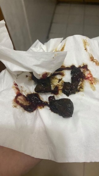 狗狗拉黑便是怎么回事，（狗狗拉黑屎,是什么情况）