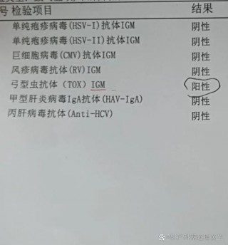 狗狗得弓形虫几率大吗，狗狗得弓形虫几率大吗知乎？