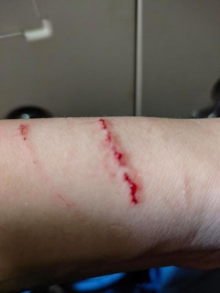 被自己家猫咪抓出血了？被自己家猫咪抓了轻微出血了（最新）