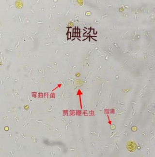 狗狗滴虫是怎么引起的？狗狗滴虫病早期症状（最新）