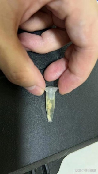 猫咪绦虫会传染人吗，猫咪绦虫会传染给其他猫吗？