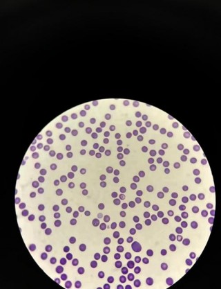 狗狗得了焦虫病的症状，狗得了焦虫病会自愈吗？