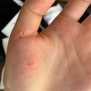 被猫咪咬破皮没出血？被猫咪咬破皮没出血要打针吗（最新）