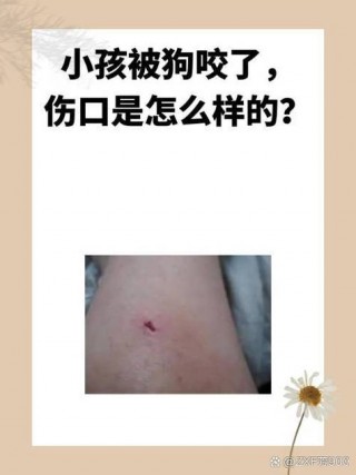 狗狗打架被咬伤怎么办，狗狗打架被咬伤会得狂犬病吗？