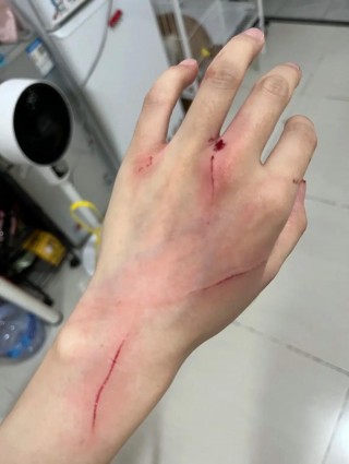 猫咪抓伤出血了怎么办？猫咪抓伤出血了怎么办需要打针吗多少钱（最新）