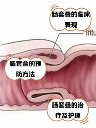 狗狗肠套叠可以自愈吗，（狗狗肠套叠可以自愈吗吃什么药）