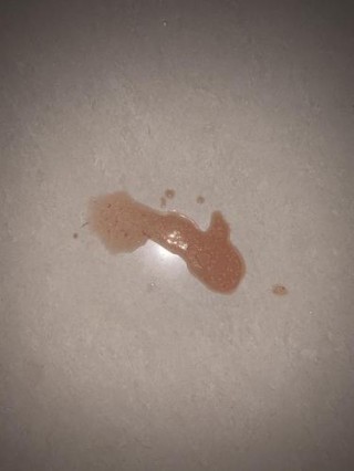 猫咪吐血是怎么回事，（猫咪吐血是什么原因造成的）