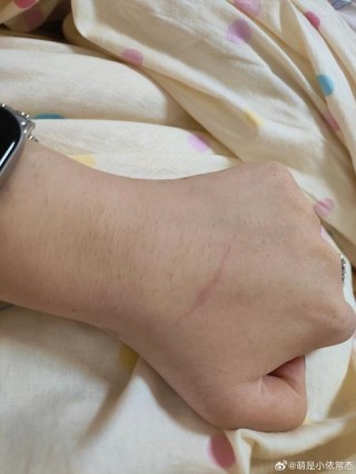 狗狗身上有疤怎么回事，（狗狗身上有很多疤型东西）