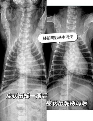 狗狗肺炎能治好吗？狗狗肺炎治愈率高吗（最新）