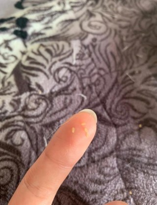 猫咪体内有绦虫的症状？猫咪体内有绦虫会传染给人吗（最新）