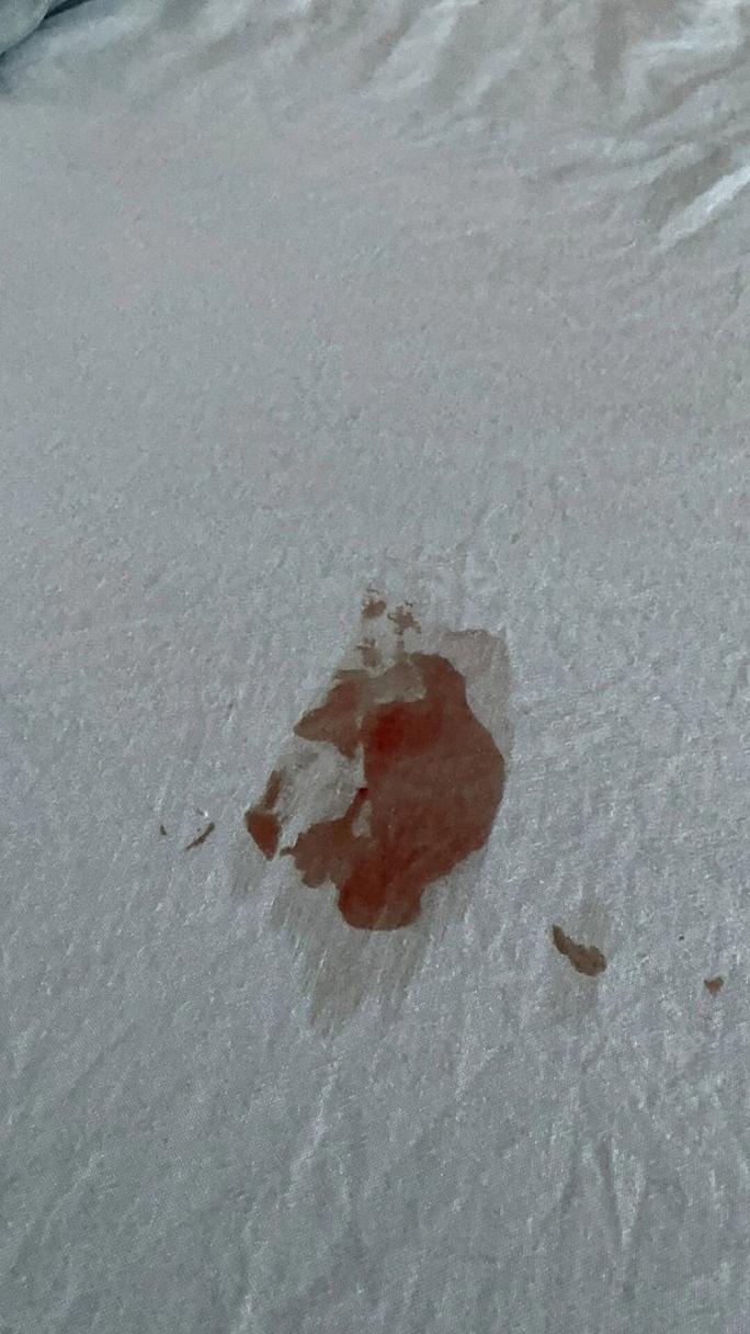 猫咪屁股为什么出血