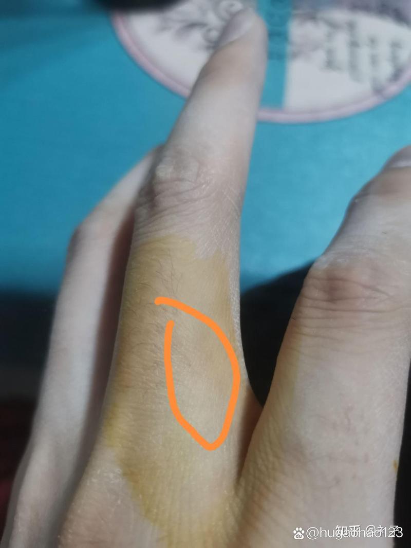 猫抓了一下有淡淡红痕没出血