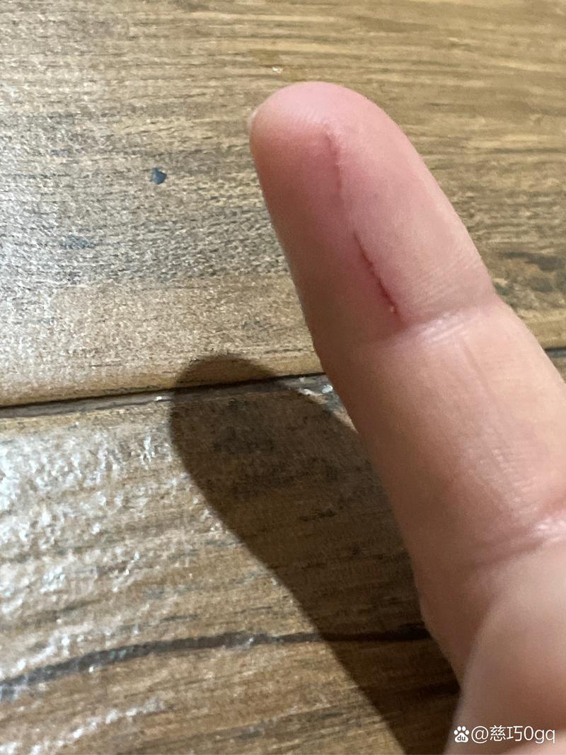 被猫抓破皮了没出血