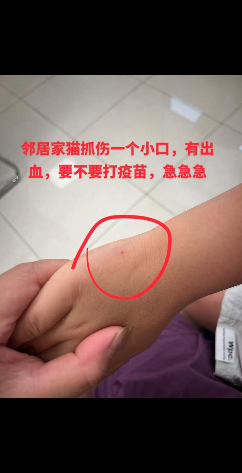 被猫抓了一下,红了一条线,没破皮,会有事吗?