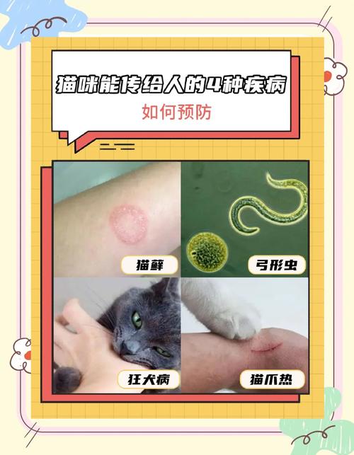 猫身上的病菌会传染给人吗