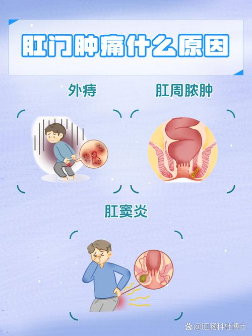 肛门腺疾病