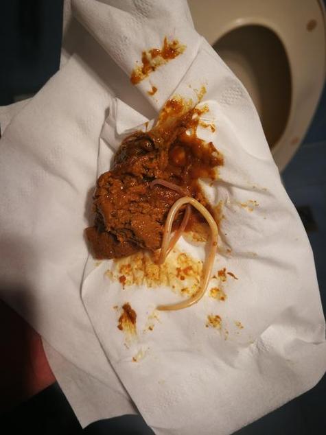 狗狗肚子里有线虫怎么办