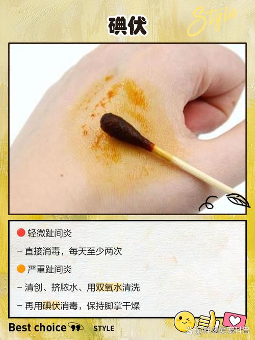 狗狗趾间炎怎么治