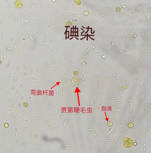 狗狗为什么会得滴虫