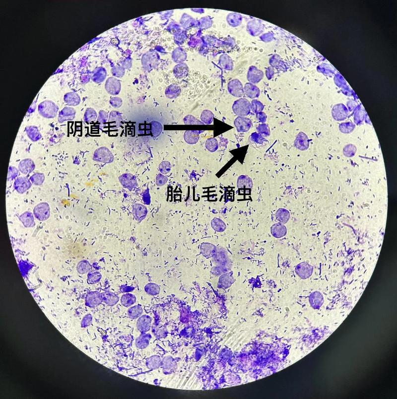 狗狗为什么得滴虫