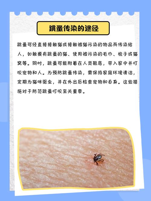 猫的跳蚤会不会寄生在人头发身上