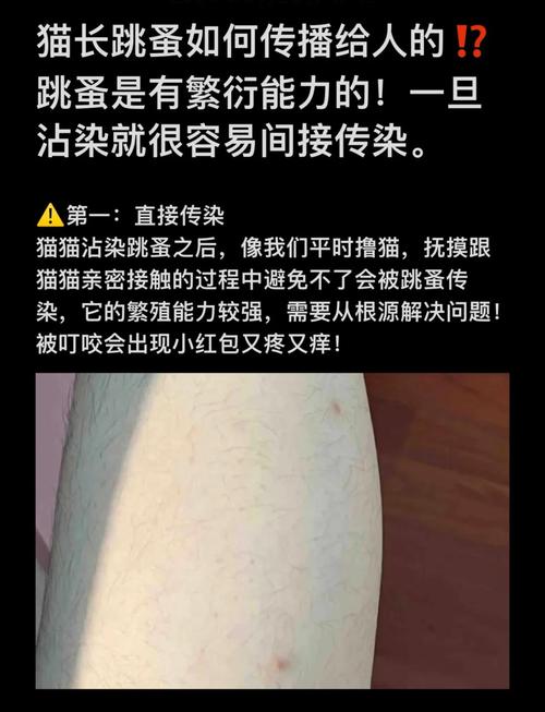 怎样防止猫咪的跳蚤传染给人啊?