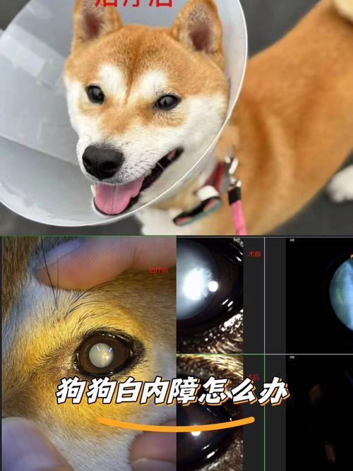 得白内障多久会失明