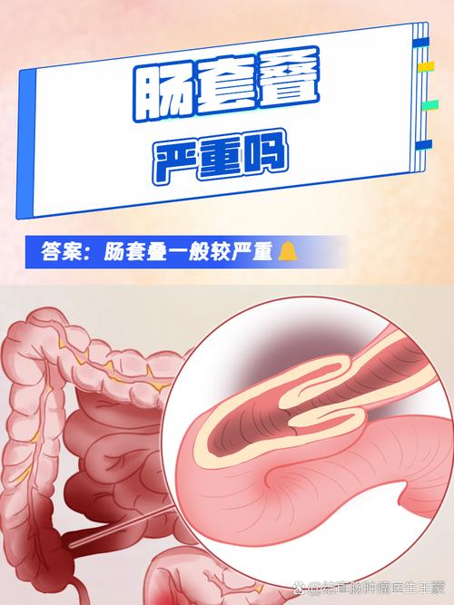 狗狗肠套叠不治疗会怎么样?