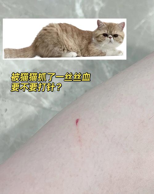 被宠物猫抓了要打针吗