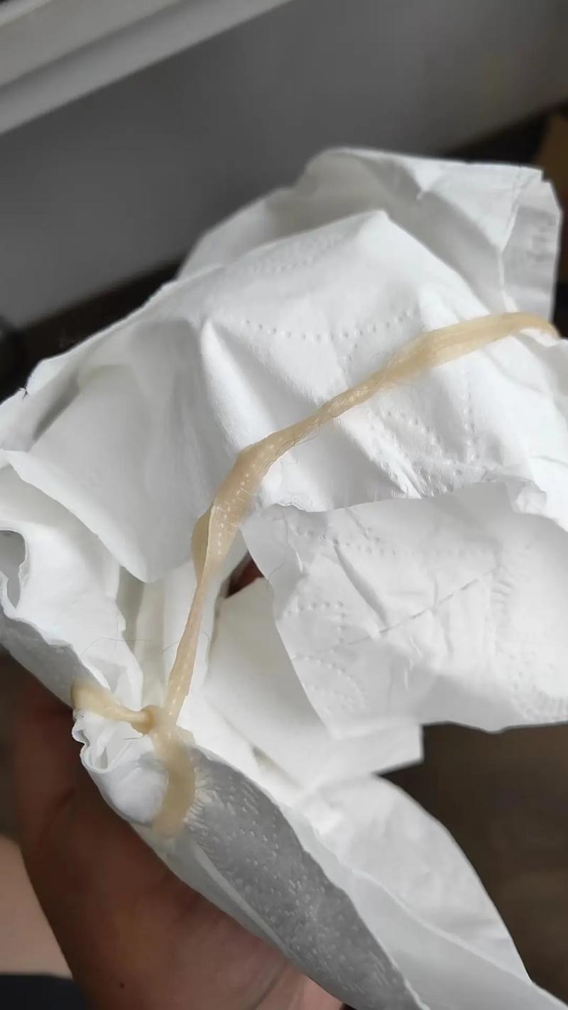 猫咪吐出了一根线一样的虫子是怎么回事?