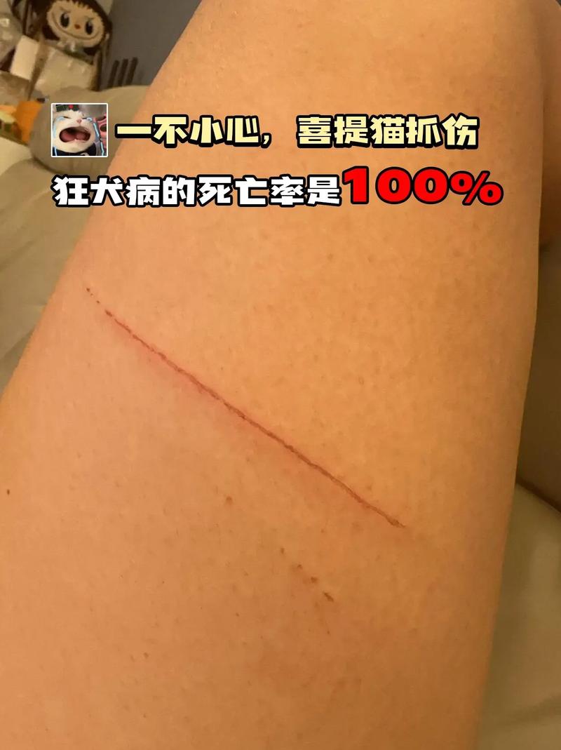 ...生的小猫很怕人,我被小猫咬了,会得狂犬病吗?很急,在