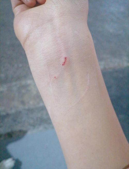 家里的狗被流浪猫抓伤