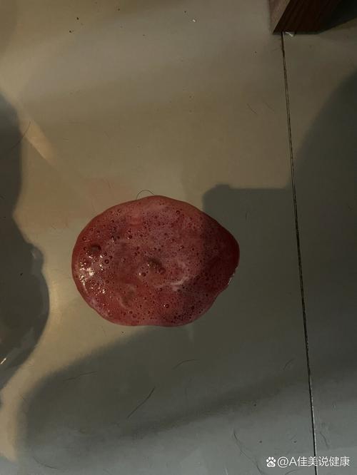 狗狗肠胃出血的症状