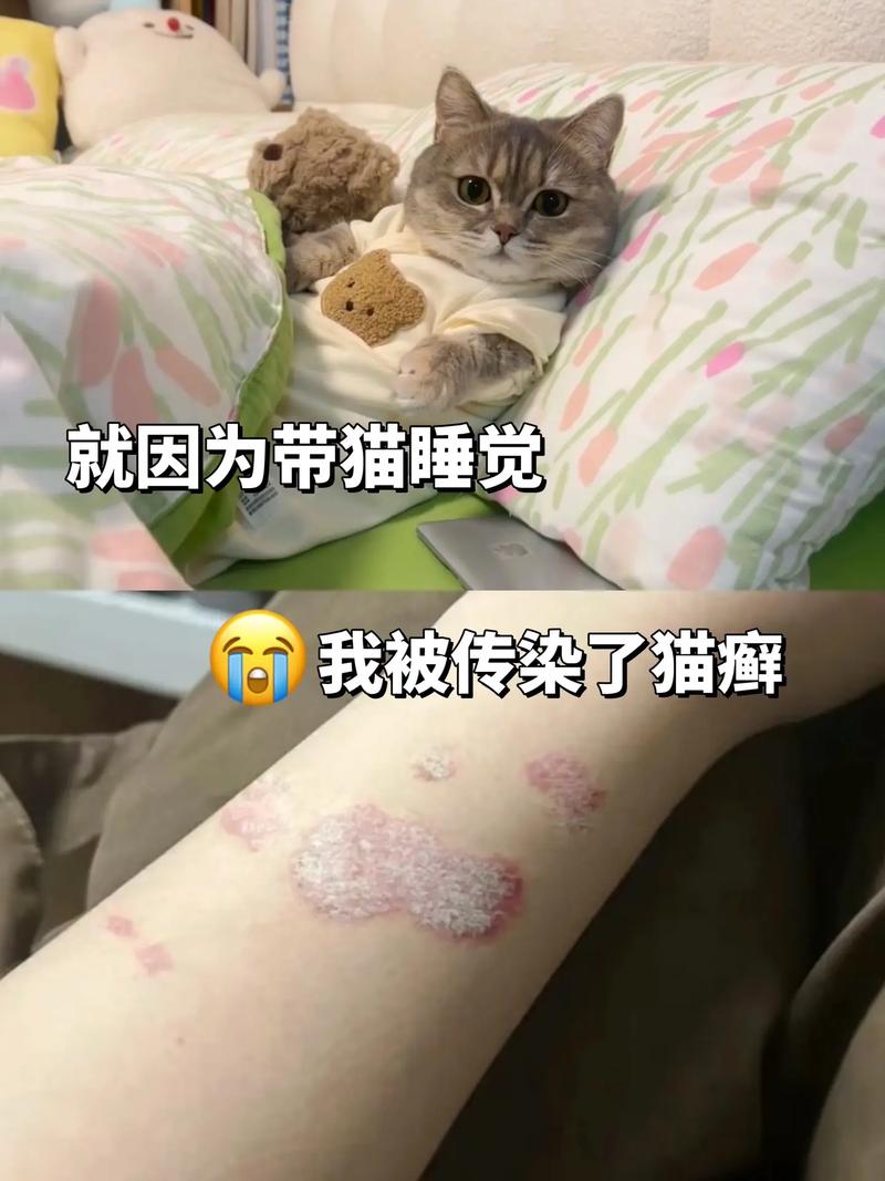 有猫藓的猫和人在一个房间会传染吗