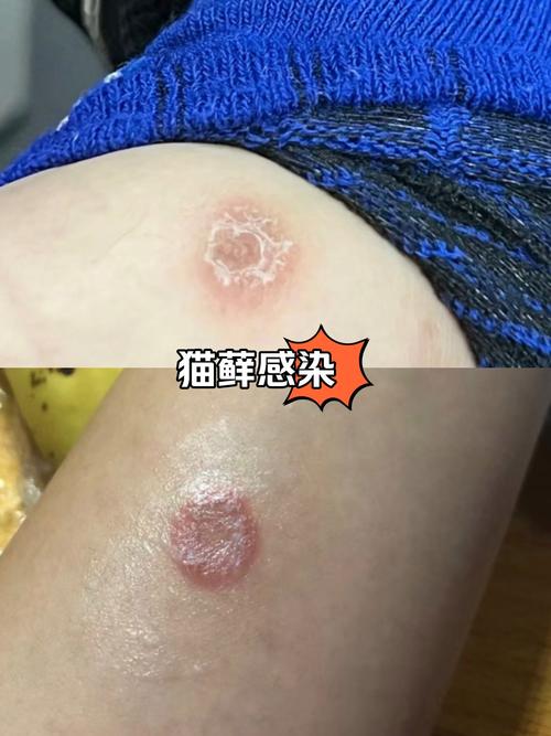 猫咪患皮肤病会有哪些症状表现?