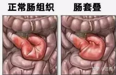 狗狗肠梗阻能自愈吗?