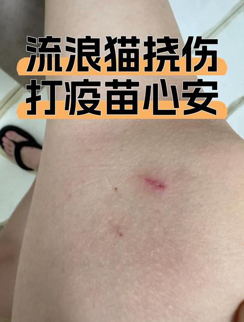 猫爪子抓了一下要打疫苗吗?