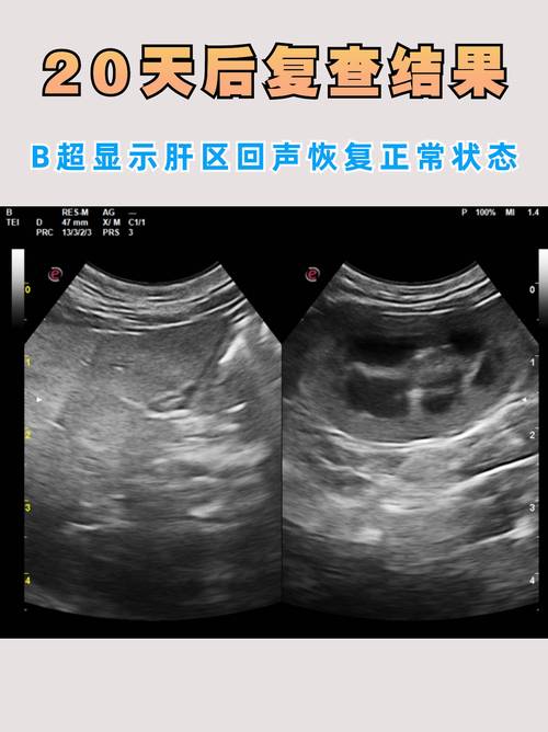 猫咪难产去医院大概多少钱