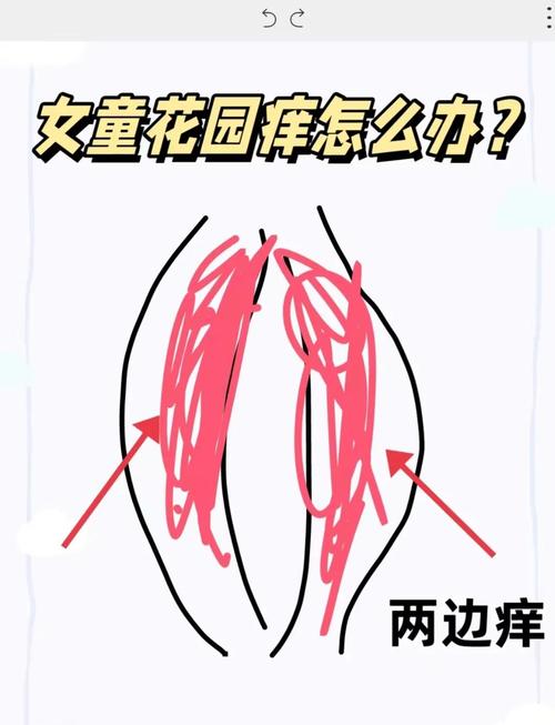 你们的痒痒肉都在什么地方?