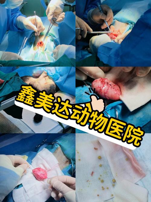 膀胱结石手术后多久可移除导尿管