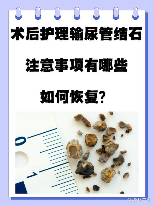 狗狗膀胱结石手术后需要消炎多少天