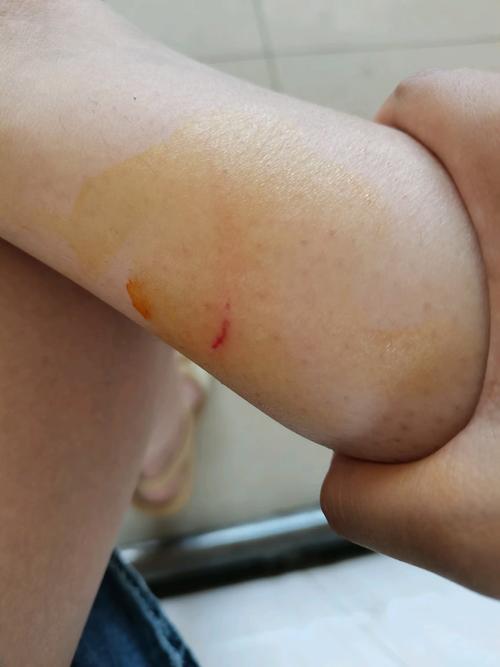 狗怕蚊子叮咬吗