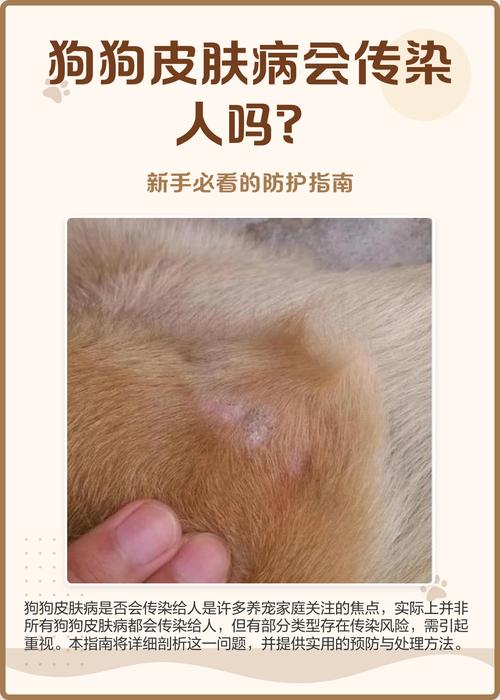 狗狗皮肤病会传染人类吗
