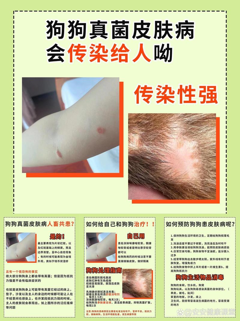 狗狗的皮肤病会传染给人吗